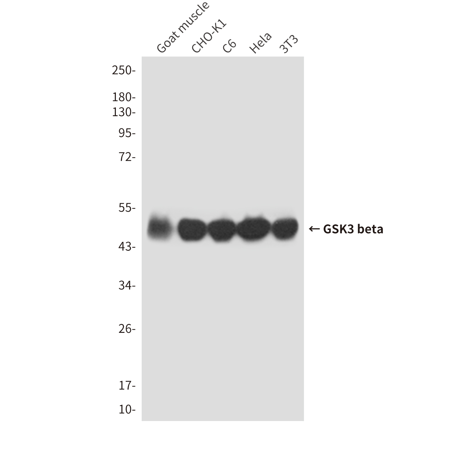 GSK3 beta