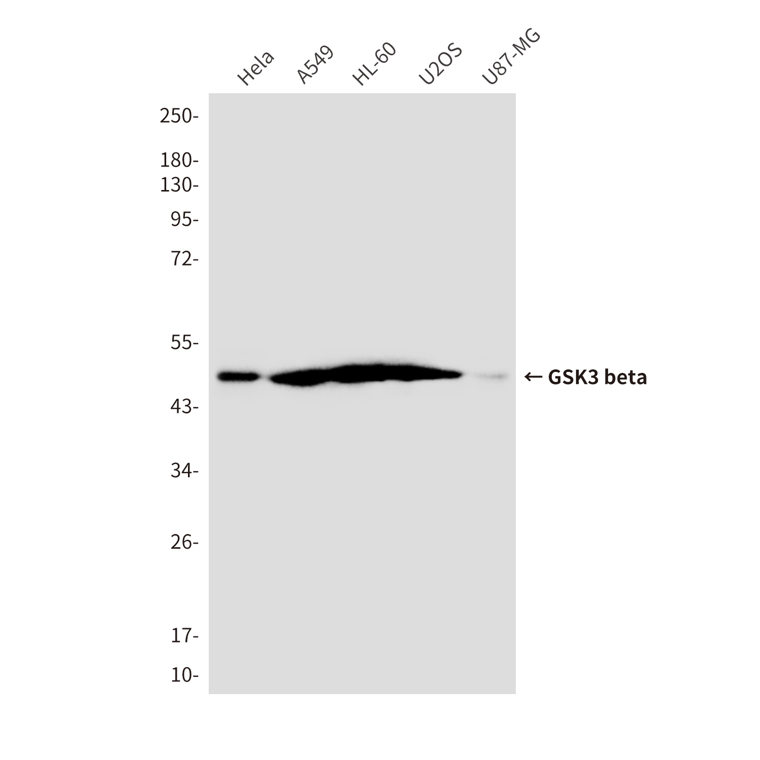 Mouse Monoclonal Antibody to GSK3 beta