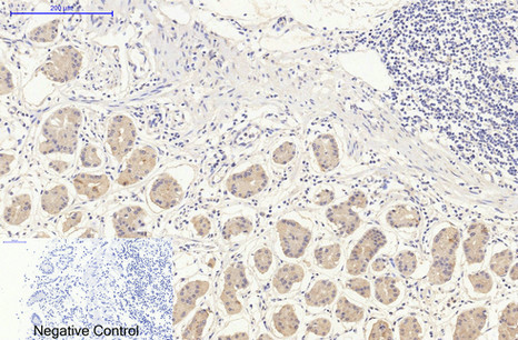 Mouse Monoclonal Antibody to DDIT3