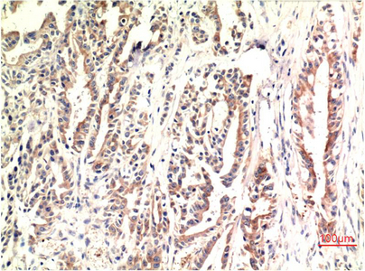 Mouse Monoclonal Antibody to DDIT3