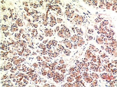 Mouse Monoclonal Antibody to DDIT3