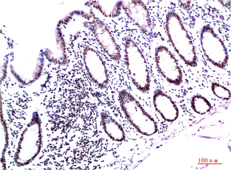 Mouse Monoclonal Antibody to HP1 gamma