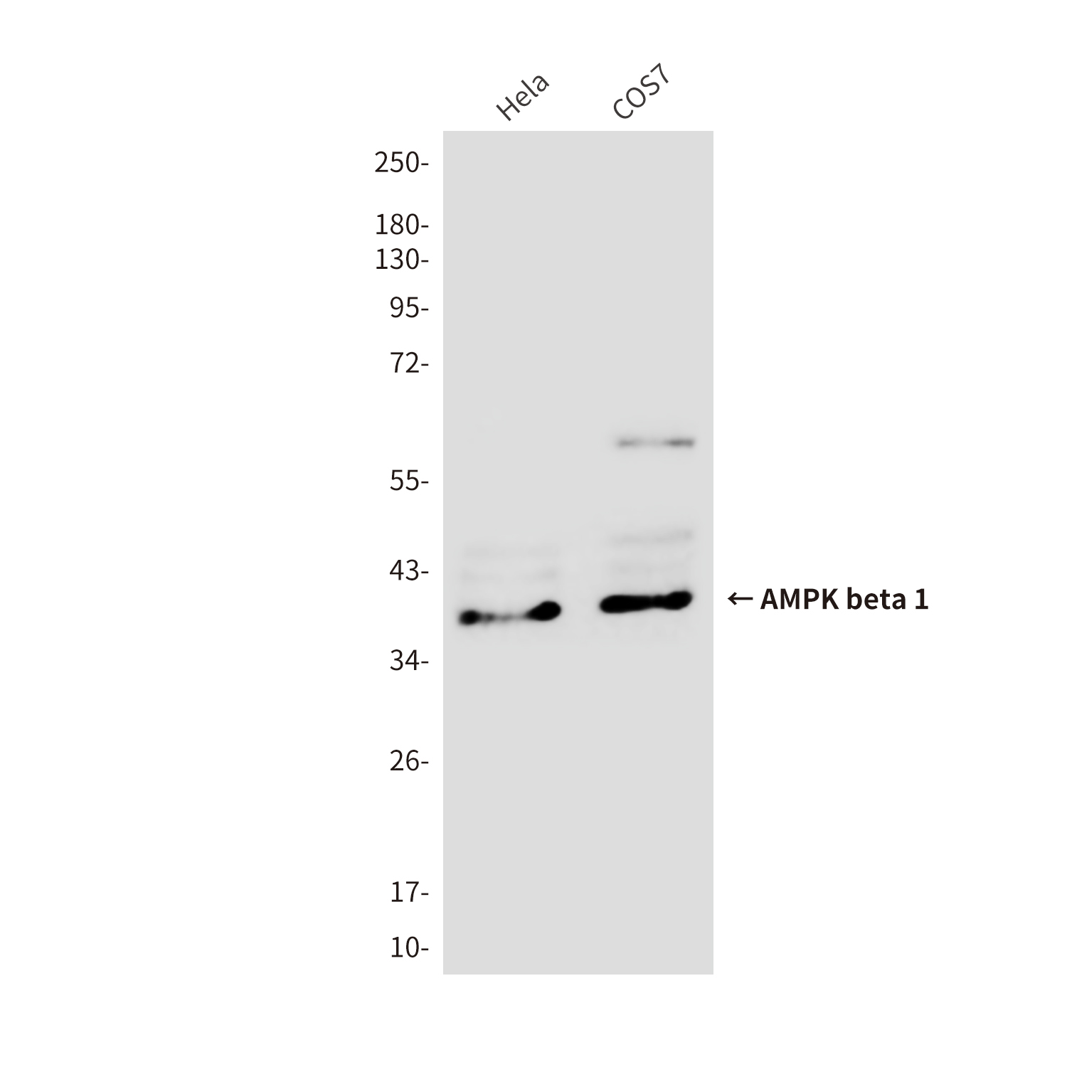 AMPK beta 1