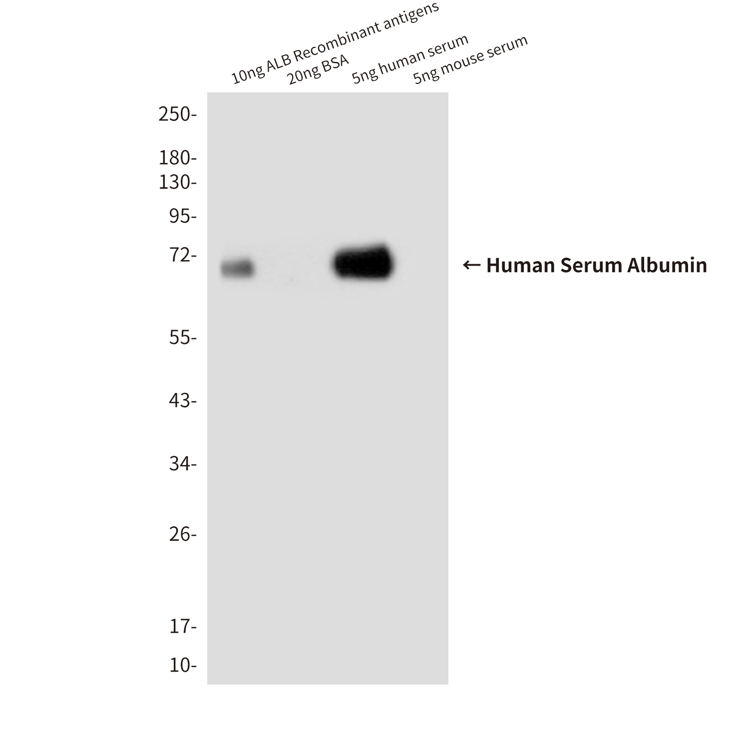 Human Serum Albumin