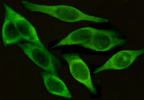 Mouse Monoclonal Antibody to ICAM1