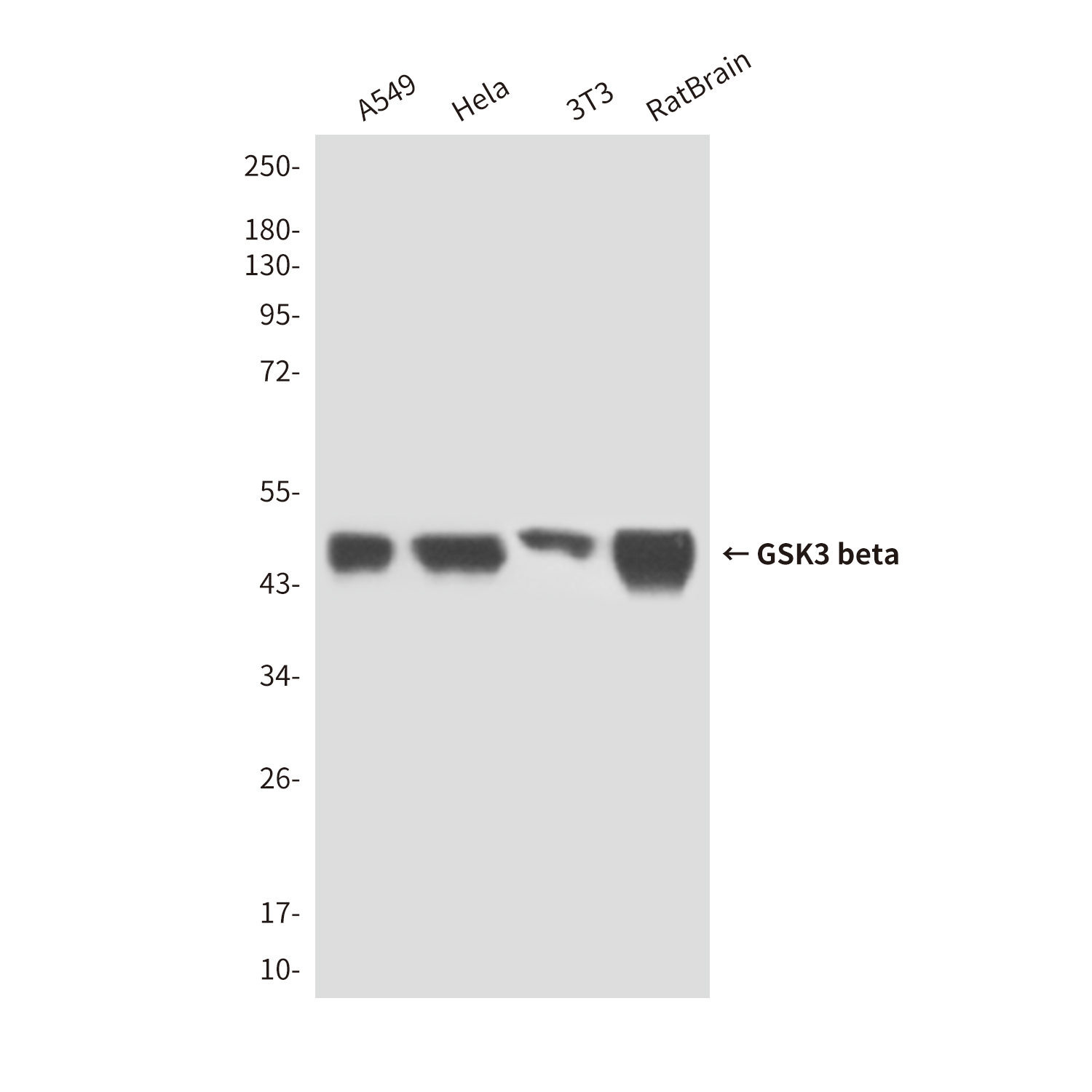 GSK3 beta