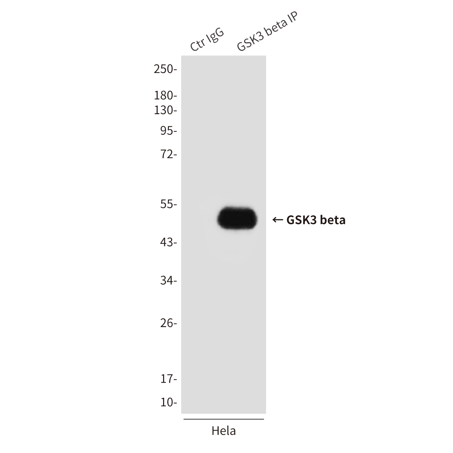Mouse Monoclonal Antibody to GSK3 beta