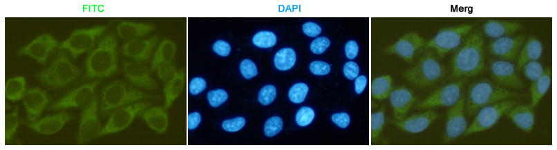 Mouse Monoclonal Antibody to GSK3 beta