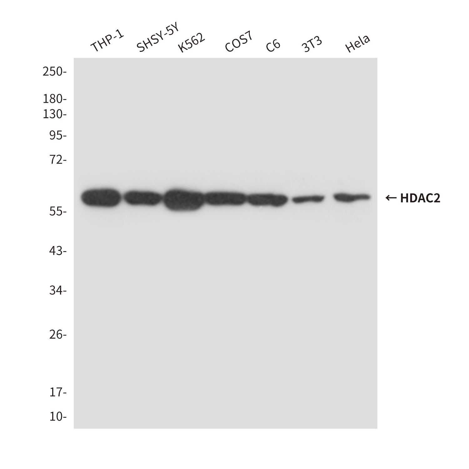 HDAC2