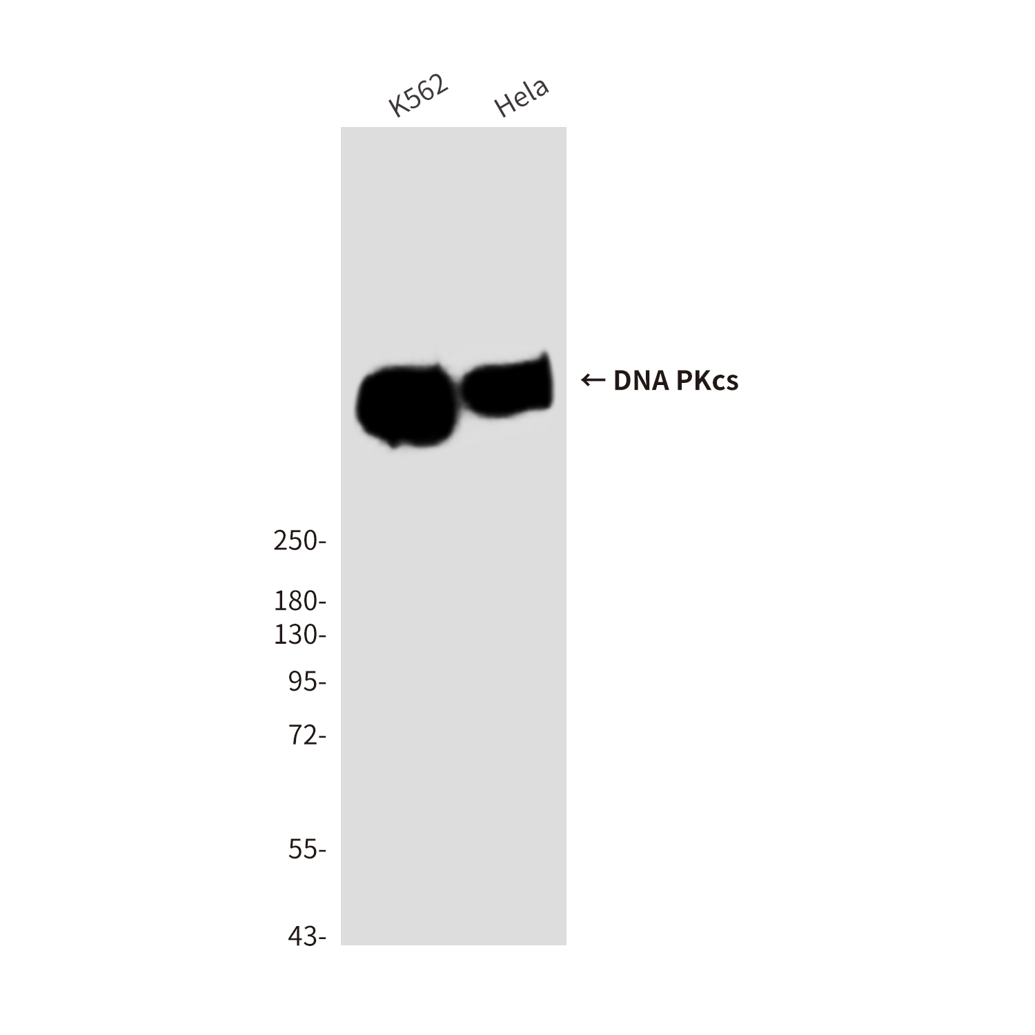 DNA PKcs