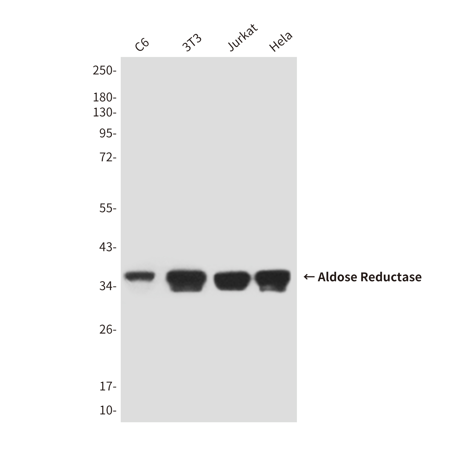 Aldose Reductase