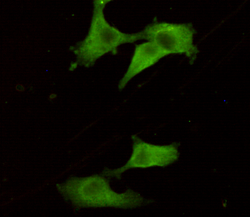 Mouse Monoclonal Antibody to PGP9.5