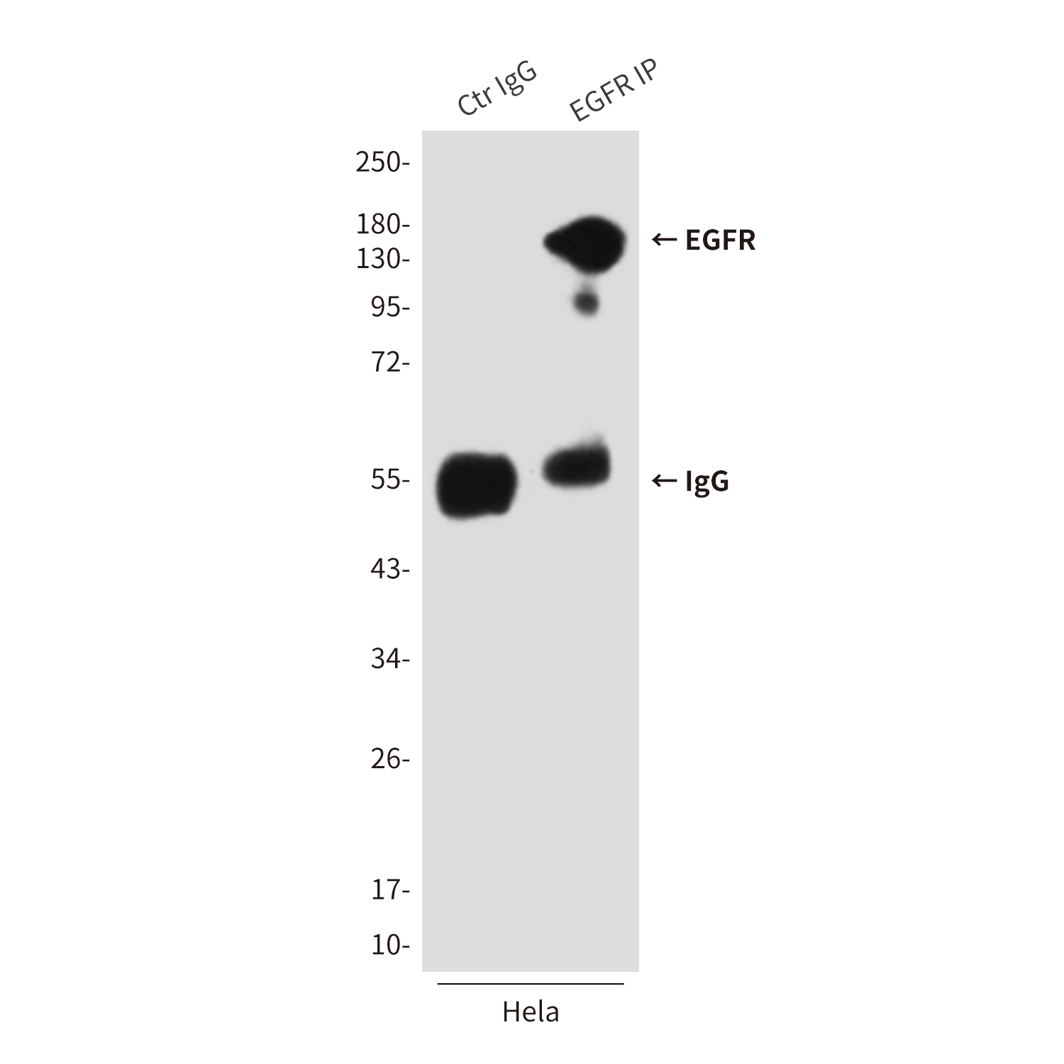 Mouse Monoclonal Antibody to EGFR