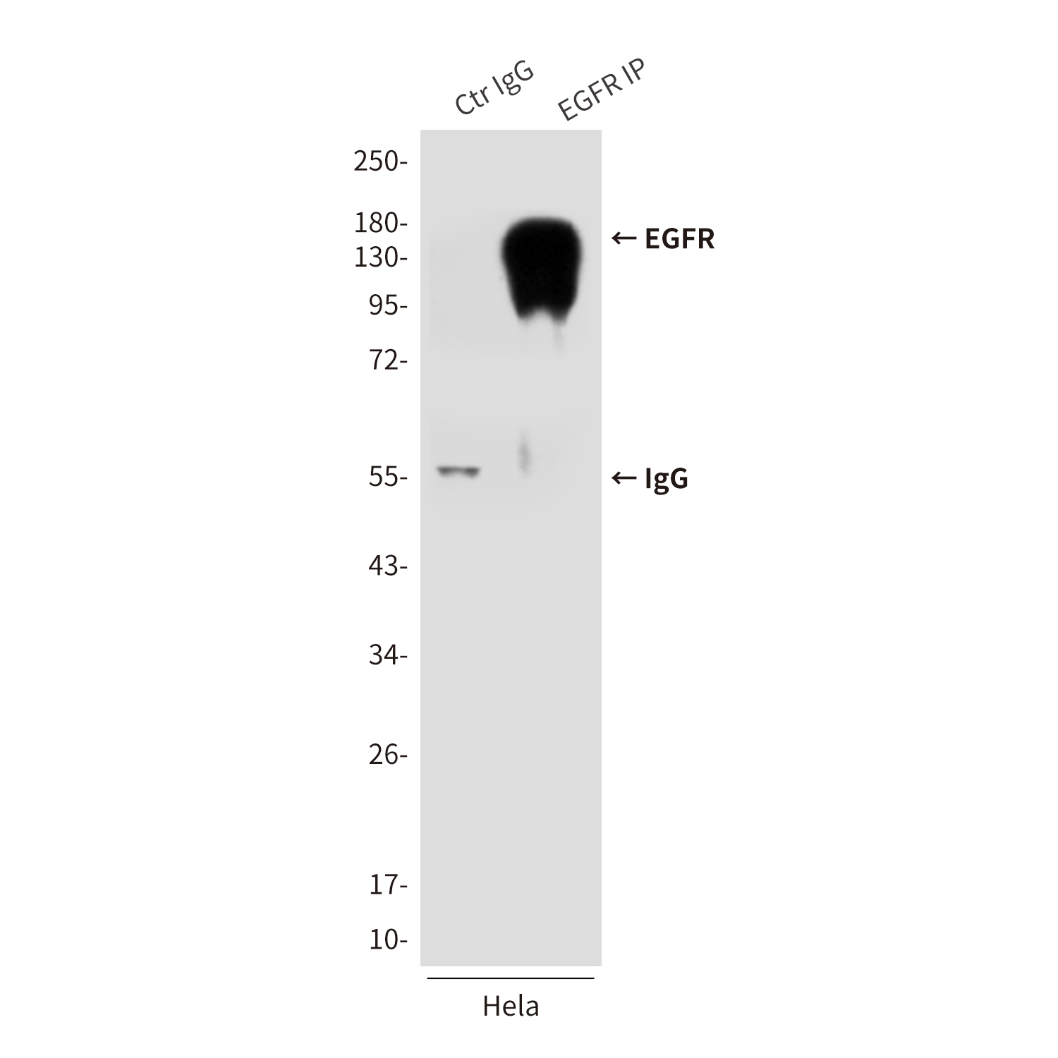 Mouse Monoclonal Antibody to EGFR