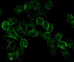 Mouse Monoclonal Antibody to EGFR