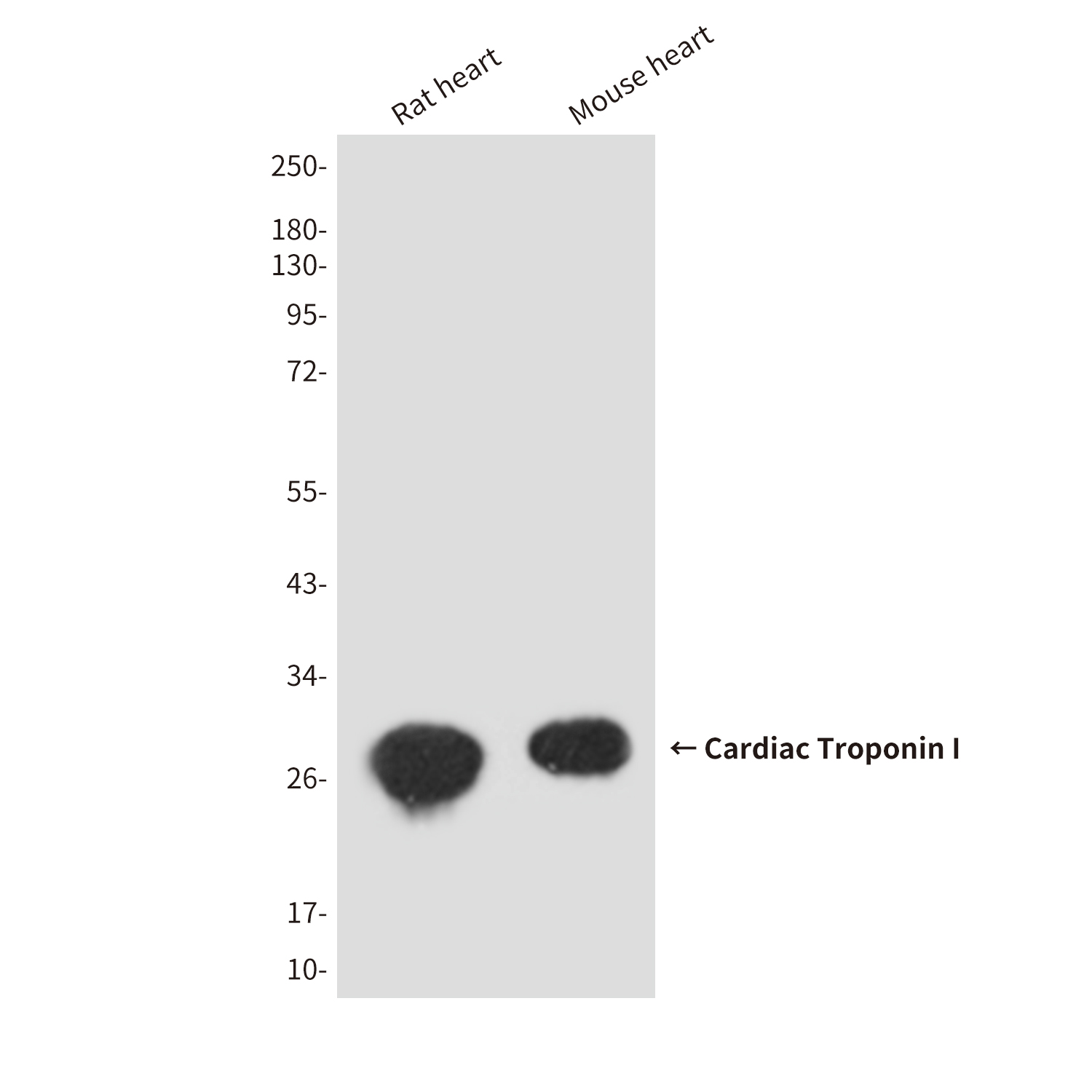 Cardiac Troponin I