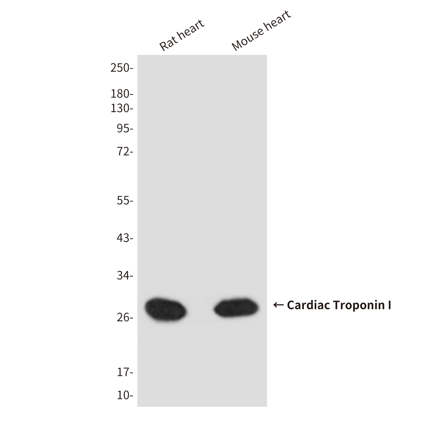 Cardiac Troponin I