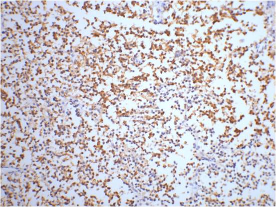Mouse Monoclonal Antibody to NSE