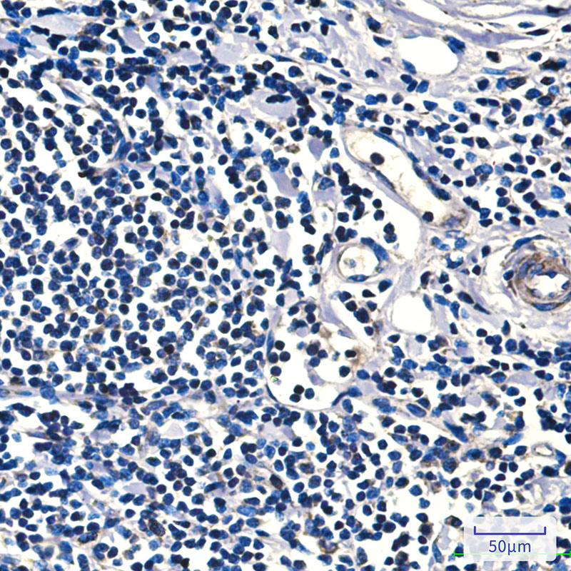 Mouse Monoclonal Antibody to FH