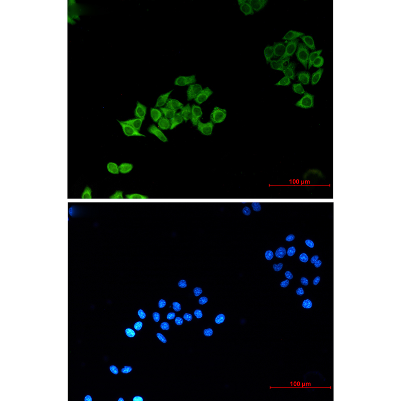 Mouse Monoclonal Antibody to ABCB5