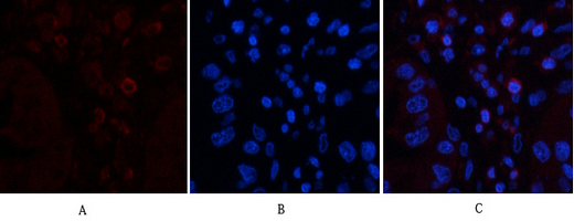Mouse Monoclonal Antibody to CD45