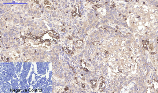 Mouse Monoclonal Antibody to CD45