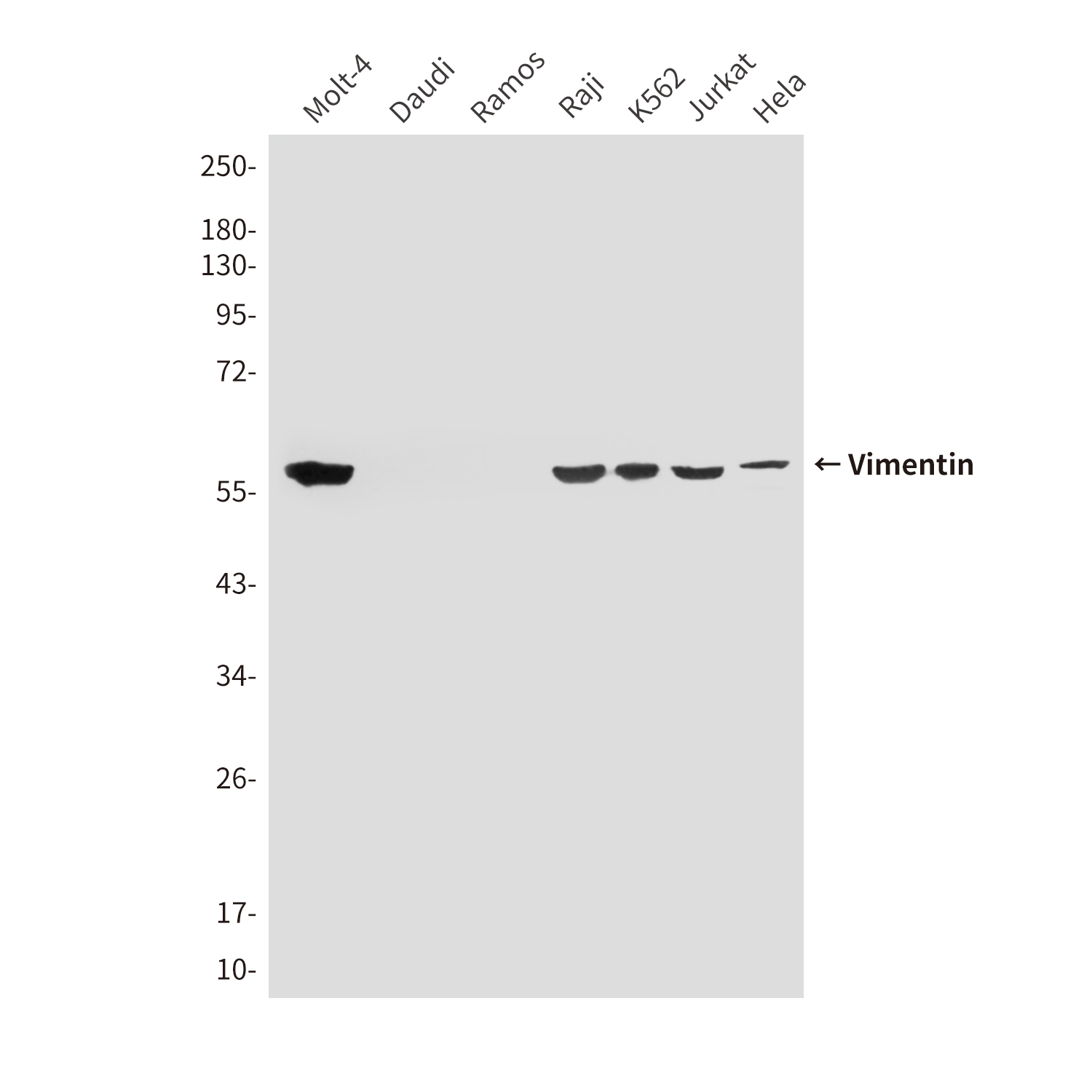 Vimentin