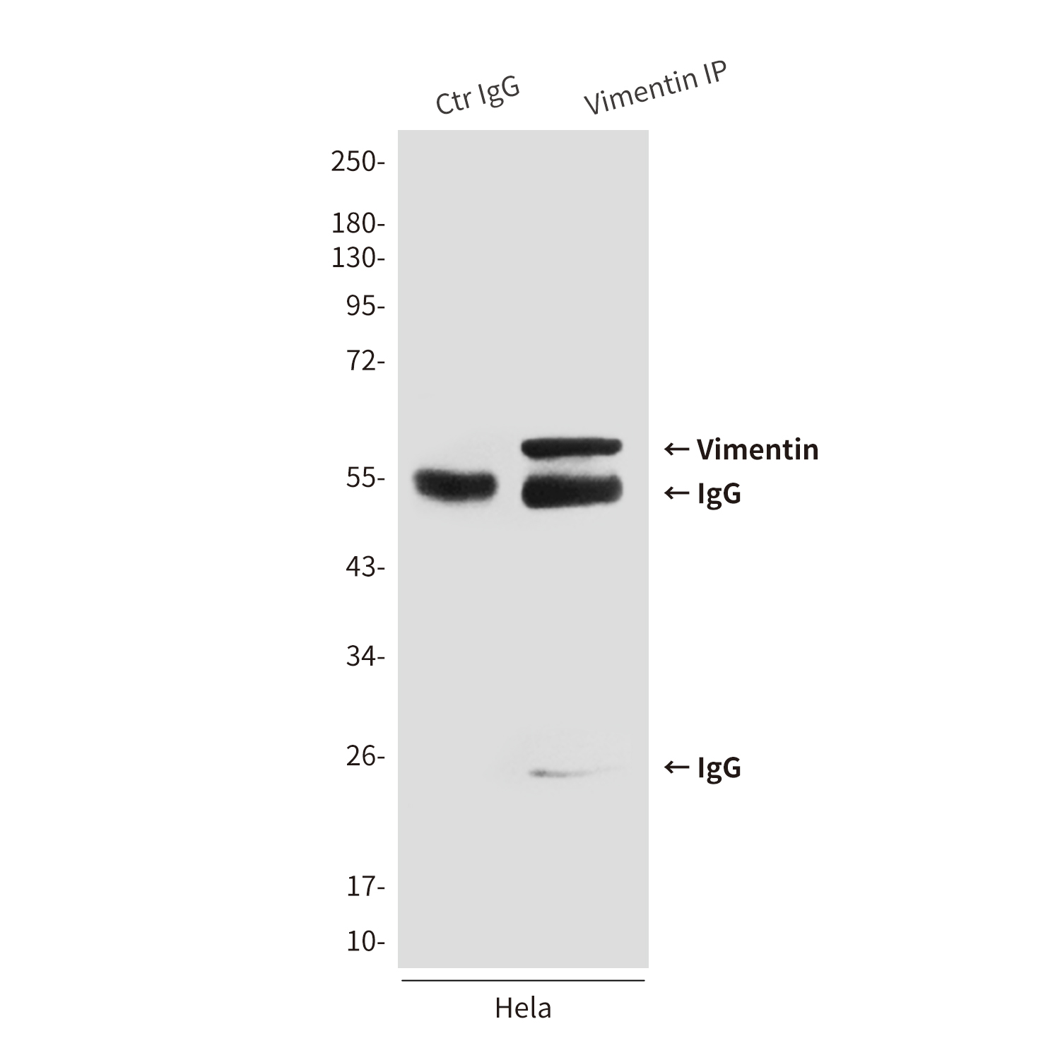 Mouse Monoclonal Antibody to Vimentin