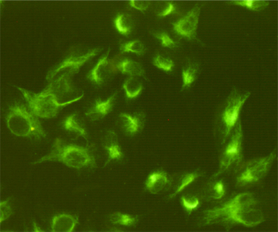 Mouse Monoclonal Antibody to Vimentin