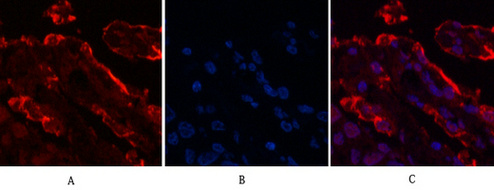Mouse Monoclonal Antibody to Galectin 3
