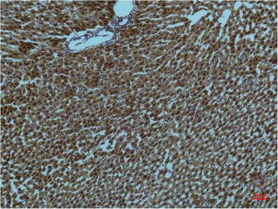 Mouse Monoclonal Antibody to PI3 Kinase p85 alpha