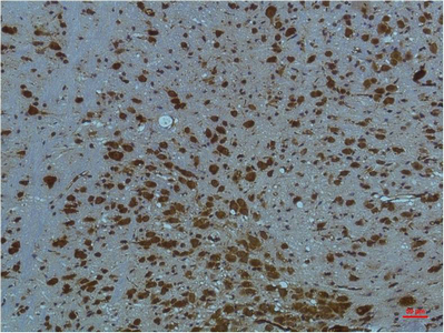 Mouse Monoclonal Antibody to PI3 Kinase p85 alpha
