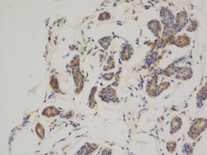 Mouse Monoclonal Antibody to Bcl2