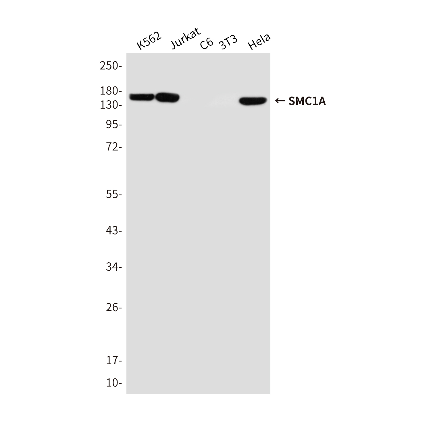 SMC1A