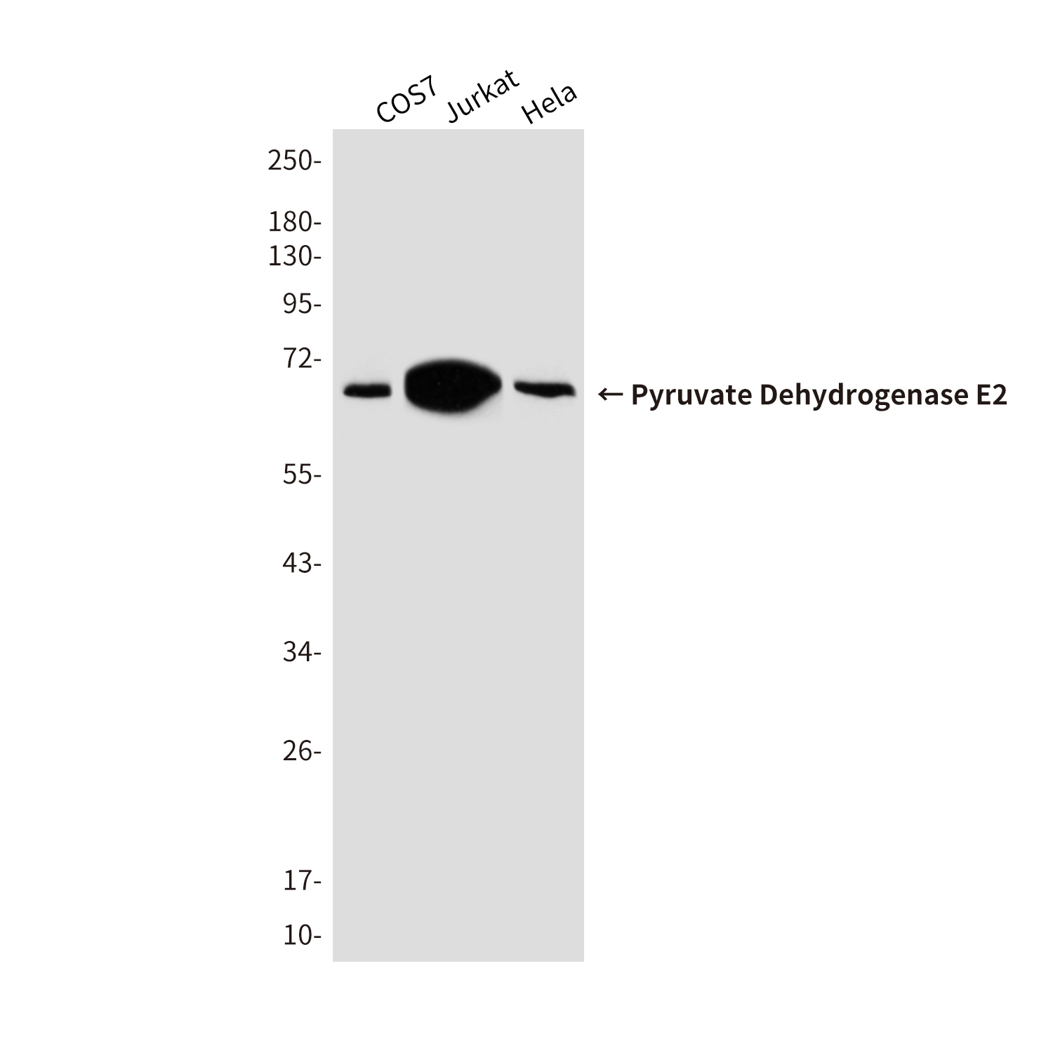 Pyruvate Dehydrogenase E2