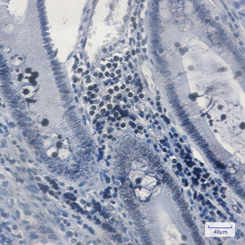 Rabbit Monoclonal Antibody to MGMT