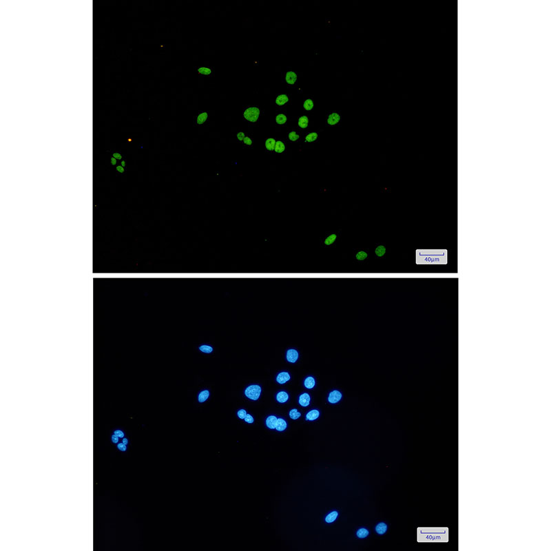 Rabbit Monoclonal Antibody to MCM6
