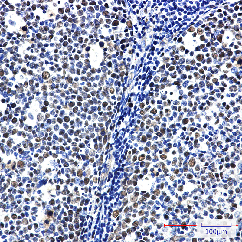 Rabbit Monoclonal Antibody to MCM6