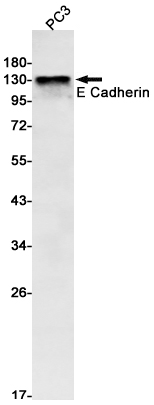 E Cadherin