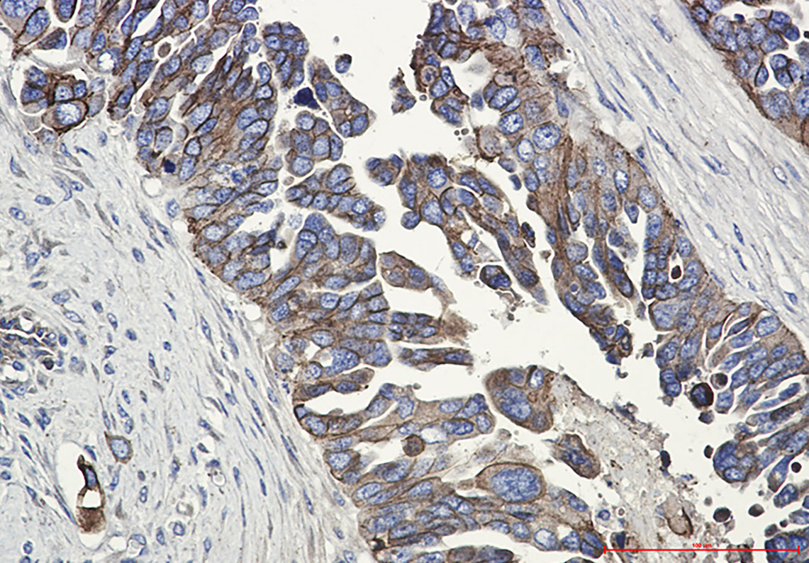 Rabbit Monoclonal Antibody to E Cadherin