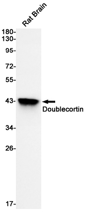 Doublecortin