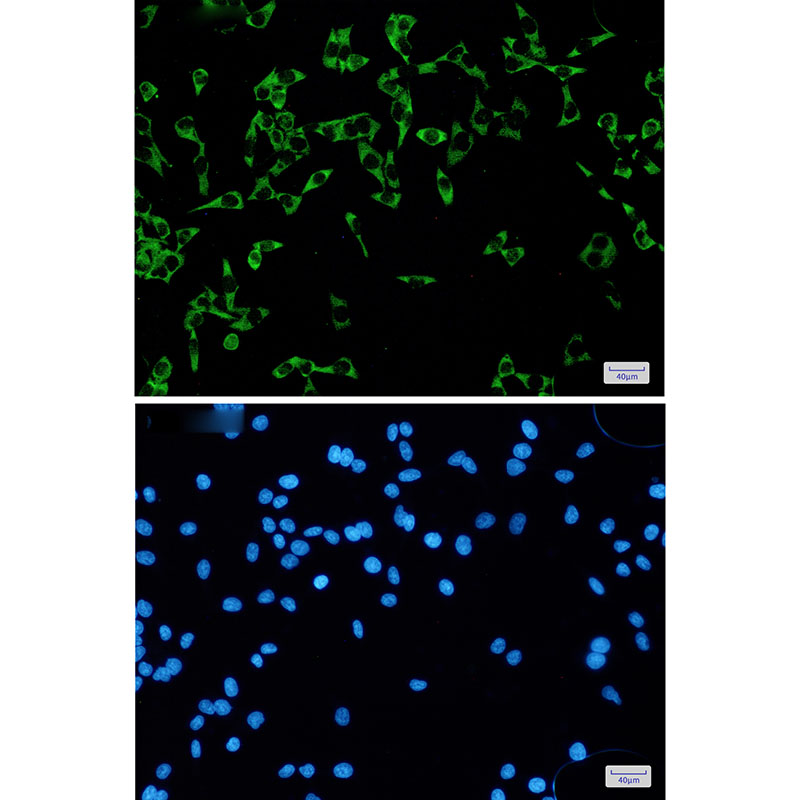 Rabbit Monoclonal Antibody to FMRP