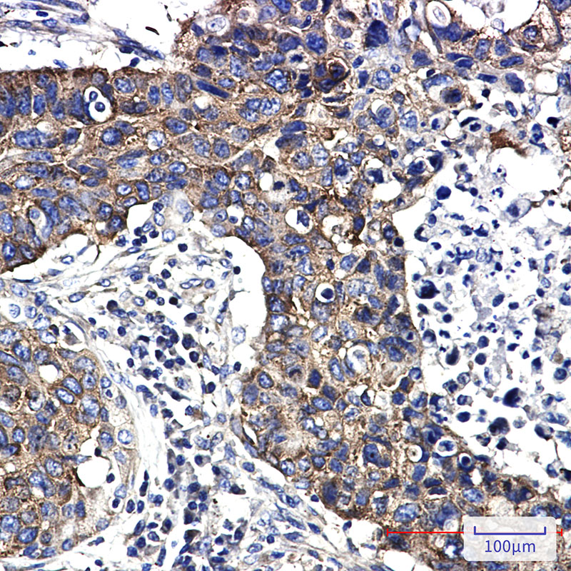 Rabbit Monoclonal Antibody to FMRP