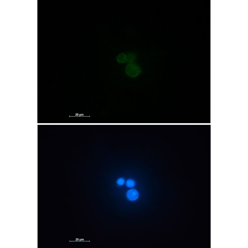 Rabbit Monoclonal Antibody to Matrin 3