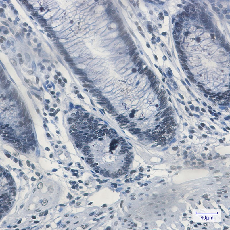 Rabbit Monoclonal Antibody to Matrin 3