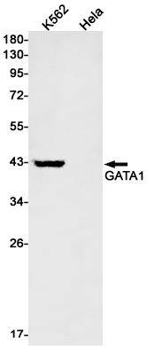 GATA1