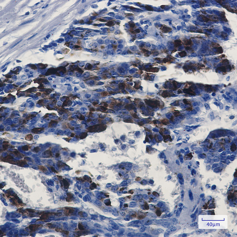 Rabbit Monoclonal Antibody to MMP14