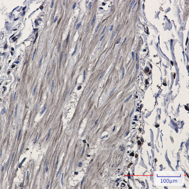 Rabbit Monoclonal Antibody to IDH1