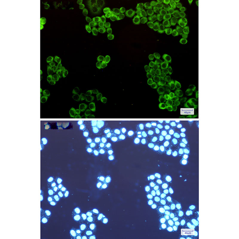 Rabbit Monoclonal Antibody to Tryptophan tRNA Ligase