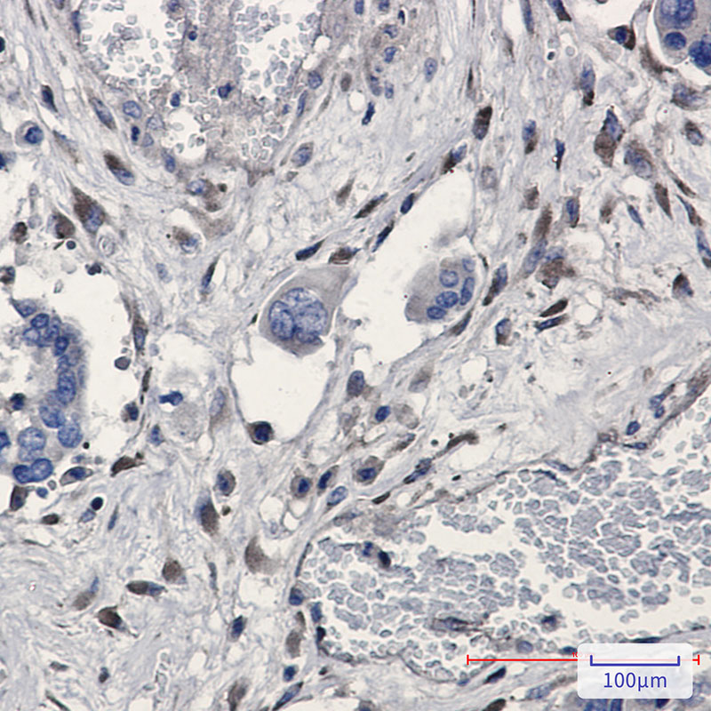 Rabbit Monoclonal Antibody to GNB2